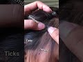 lice infestation #headliceremoval #licecomb #headlice #headlicetreatment #hairlice #haircare #hair