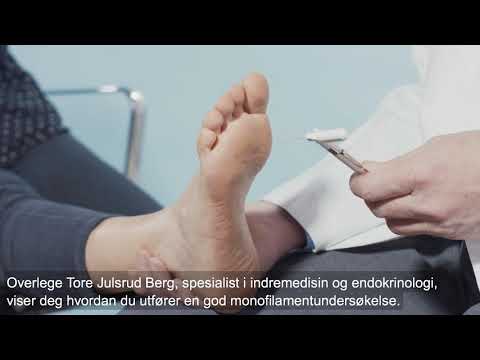 Diabetisk fot og nevropati -  Teaser 3