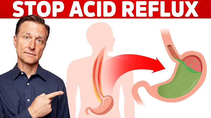 How to STOP Acid Reflux Instantly