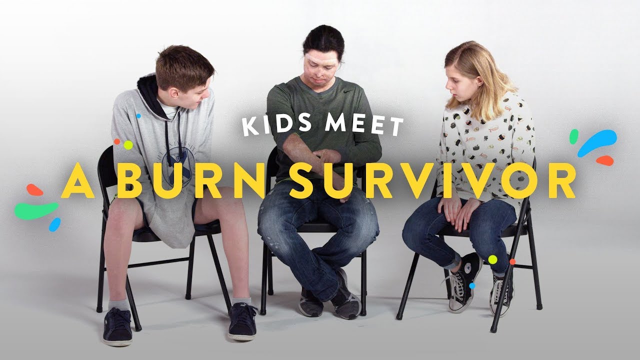 Kids Meet a Burn Survivor | Kids Meet | HiHo Kids