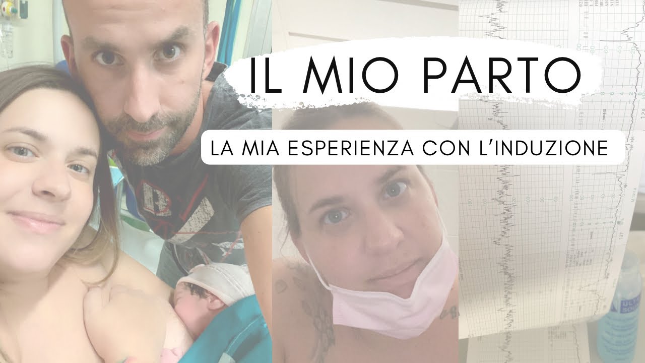 Il mio PARTO | Induzione programmata