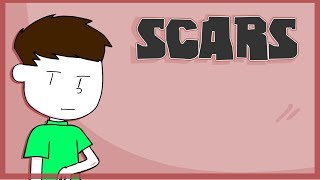 Scars