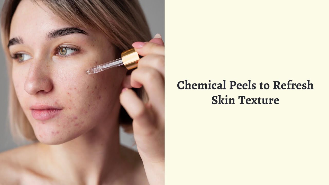 Charming Skin Vein Clinics - Best Treatments to Fade Acne Scars Fast and Safely
