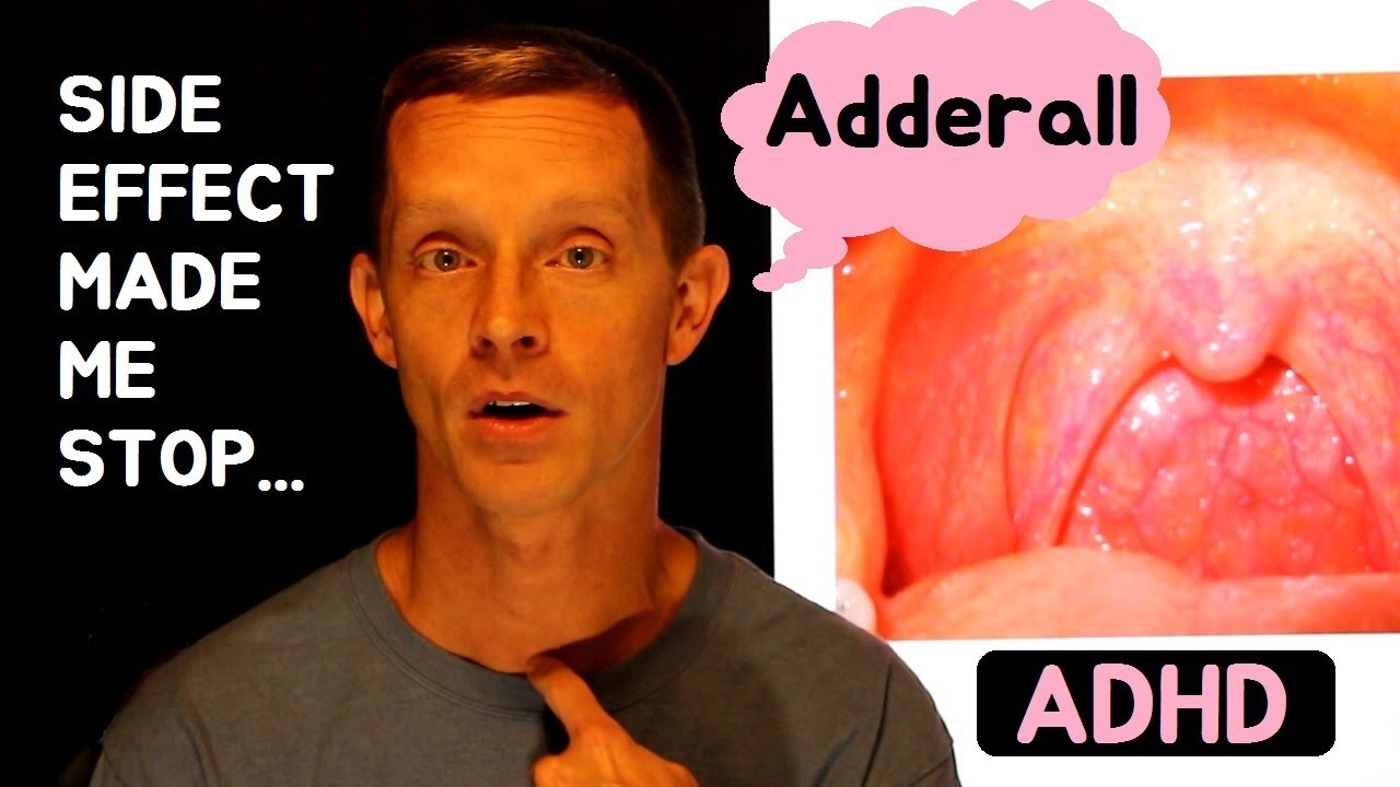Side Effect of Adderall Made Me Stop Dry Mouth & Sore Throat ADHD YouTube