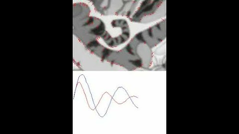 Real Time (Optical Flow ) Feature Tracking and Camera motion