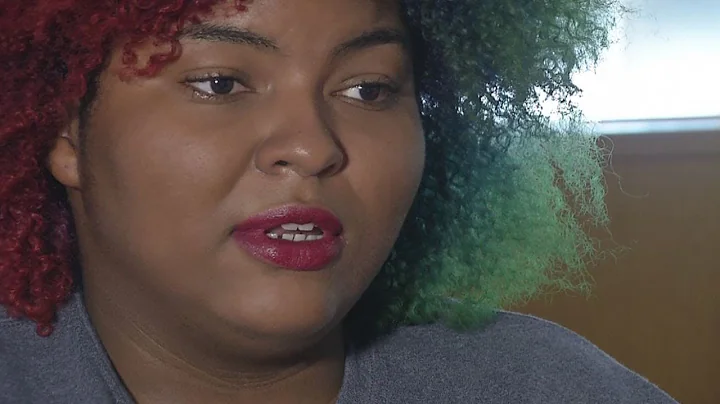 Fireball victim speaks out