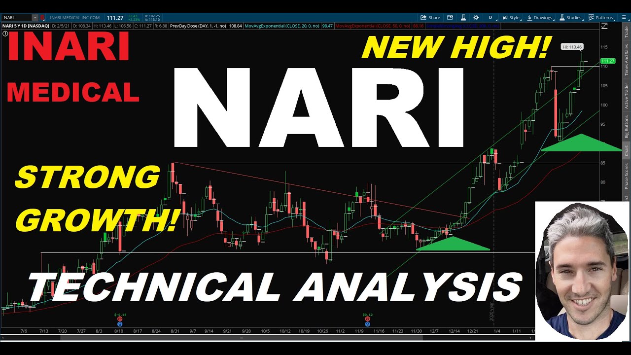 Inari Medical Inc. (NARI) - Technical Analysis February 6th, 2021. Growth Stock Hitting New Highs!