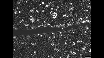Scratch Assay carried out on HaCaT cells