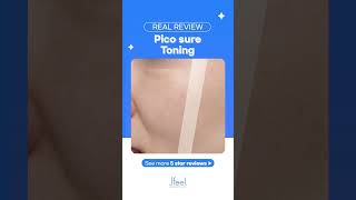 Disclosure The Procedure Process Of Pico Suretoning