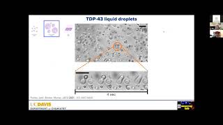Dr. Dylan Murray and Dr. Henry Paulson - ZOOMinar on Proteinopathy (April 4 2022)