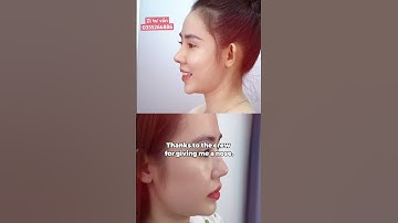 Nâng mũi lần 2 nhưng còn đẹp hơn lần đầu, có thật không…?? #jlinekorea #nangmuitrunghoa