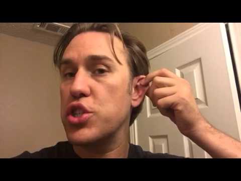 Cauliflower Ear - how to drain and treat