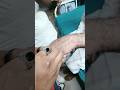#cannula 22no #trendingshorts #medicalstudent #doctorstrange #nursing #aakhil jack