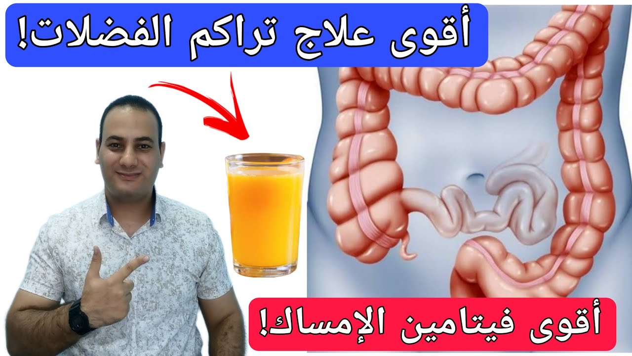 أقوى فيتامين لعلاج الامساك نهائيا في دقائق/وصفة مجانية للتخلص من الفضلات المتحجرة والتهابات القولون