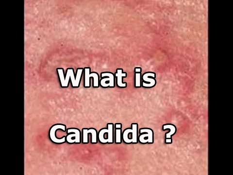 candidiase remedio