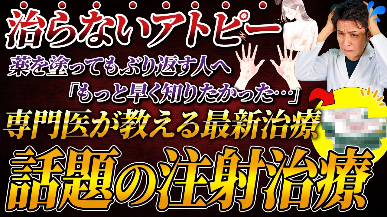 【医師解説】アトピーで悩んでいる人へ。デュピクセントを使うべき人・使わない方がいい人効果・副作用・費用を正直に話します