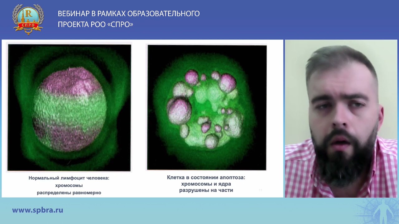 Обеспечение радиационной безопасности пациентов и персонала в лучевой диагностике. 18 мая 2021г