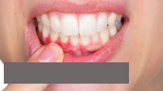 7 Key Signs of Gum Problems and Why You Should Visit the Best Dental Clinic in Punjab
