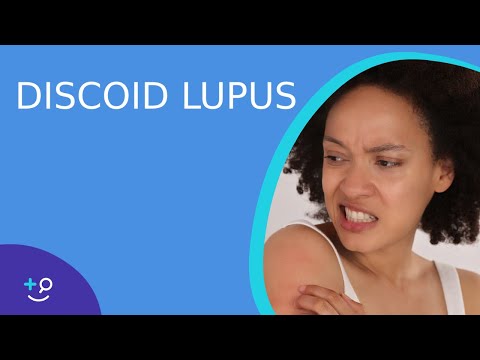 Video: Discoid Lupus: Huiduitslag Symptomen, Behandeling En Oorzaken