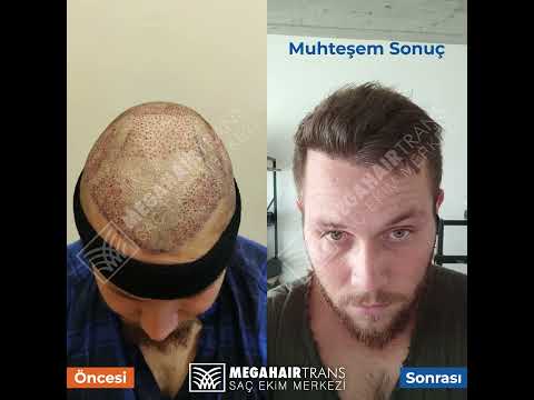 Ağrısız ve Acısız