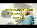 Компьютерная томография зубов в стоматологии (Киев)