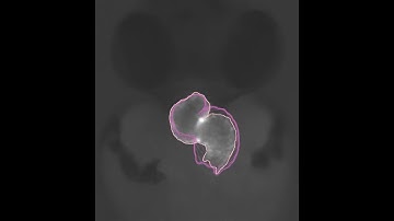 High-resolution reconstruction of the beating zebrafish heart 1