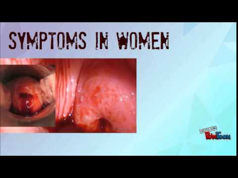 signs and symptoms of gonorrhea youtube