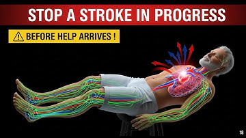 Recognize a Stroke in 60 Seconds 🧠 The FAST Test Every Senior Must Know | Save a Life Today!