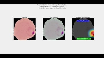 Malaria Detection using Deep Learning