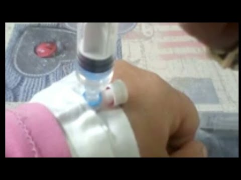 كيفية اعطاء حقنة فى الكانيولا ازاى تحقنى اطفالك ونفسك         