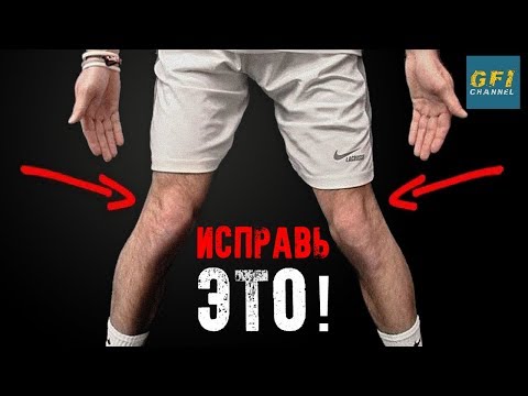 Как Исправить Вальгусное Колено (КРИВЫЕ НОГИ!)