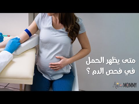 متي يظهر الحمل في فحص الدم أول علامات الحمل في بدايته بالأيام الأولى