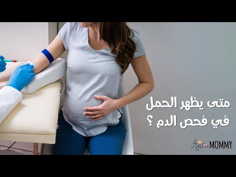 فيديو: متى يتم اختبار تحليل الدم؟