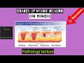 stages of wound healing Pathology lecture in hindi||pathology lecture||stages of wound healing