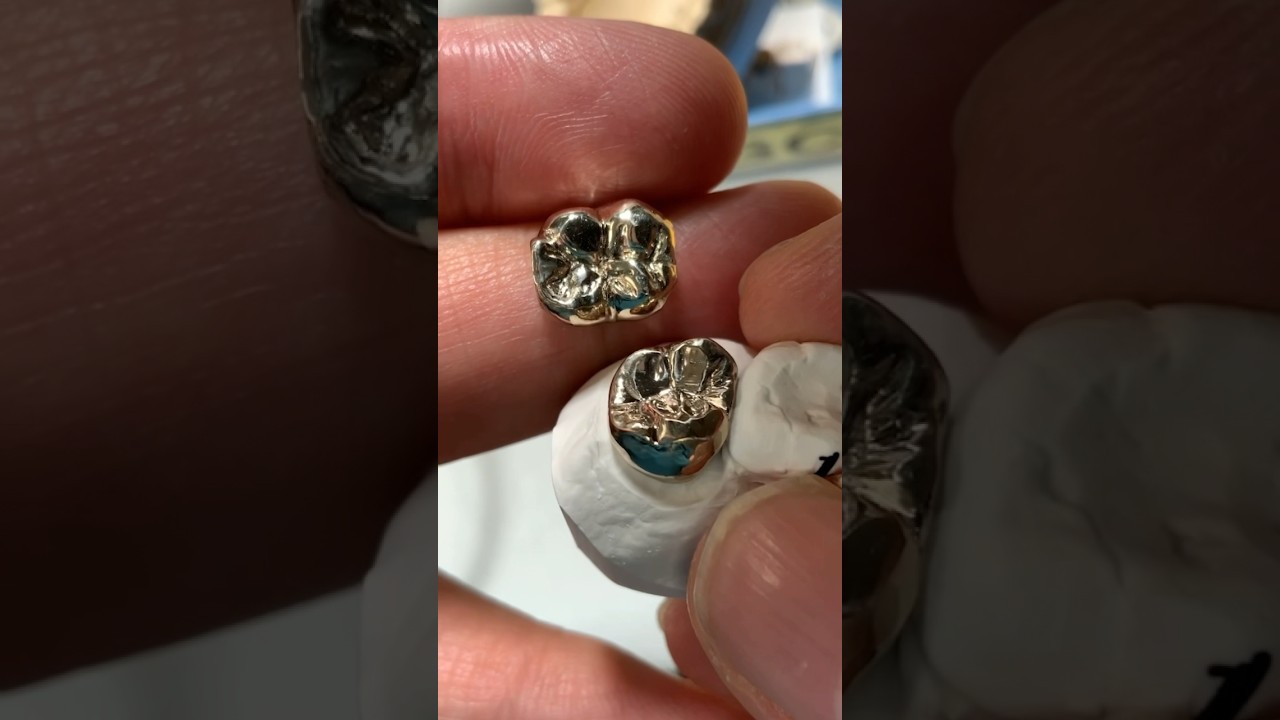 Detailing and Polishing Gold Crowns 