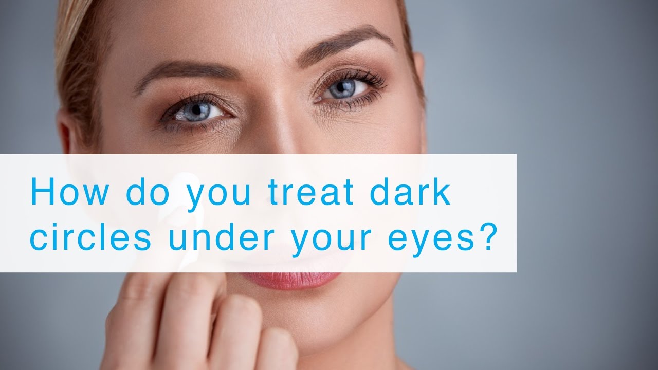 How do you treat dark circles under your eyes?