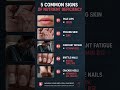 What is your body trying to tell you? #youtubeshorts #stayhealthy #healthyfood #viral
