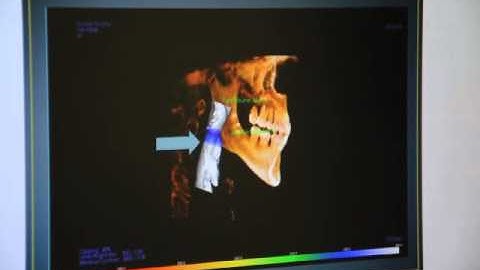 Dr. Buddy talks about Airway Analysis