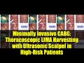 Minimally Invasive CABG: Thoracoscopic LIMA Harvesting with Ultrasonic Scalpel in High-Risk Patients