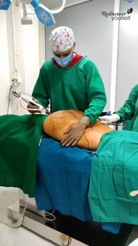 VIBRASAT PRO - Power Assisted Liposuction in Pune at Dhanwantari's Chrysalis