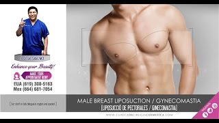 Male Breast Liposuction Cosmetic Surgery - Ginecomastia Tijuana