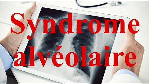 Qu'est-ce qu'un syndrome Alveolaire ?