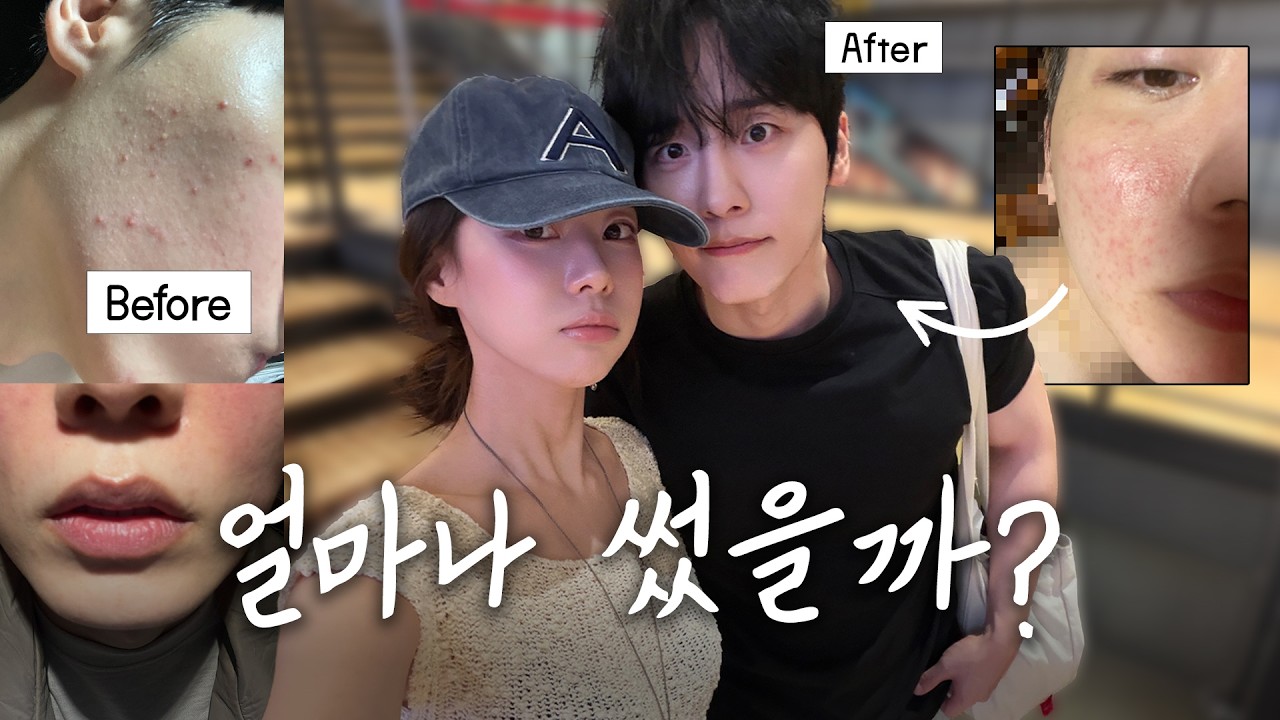광고는 없구요, 2주만에 피부가 좋아지고 싶다면 환영합니다.