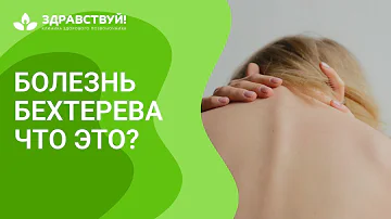 Анкилозирующий спондилоартрит или болезнь Бехтерева