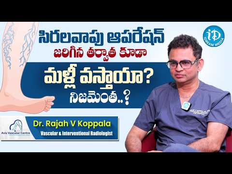 Dr Rajah V Koppala about Vericose Veins Treatment | Avis Hospitals | iDream Media - IDREAMMEDIA