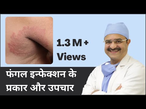Types Of Fungal Infection & Treatment For Fungal Infection | ClearSkin, Pune | (In HINDI)