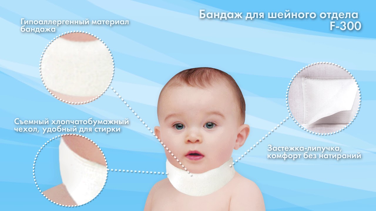 Перепончатая Шея У Детей До Года Фото