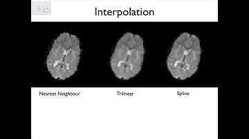 3. Registration: Cost Functions, Interpolation and Masks (Reg E3)