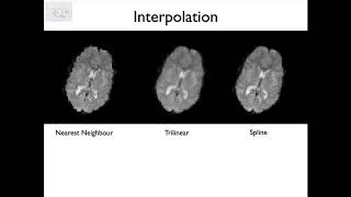 3. Registration: Cost Functions, Interpolation and Masks (Reg E3)