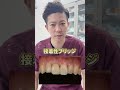 【保険治療】歯を1本失った際、保険でできる歯をほぼ削らない治療法!
